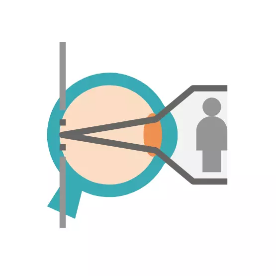 การตรวจสายตาที่เกี่ยวข้องกับการหักเหของแสงจากกระจกตาถึงจอรับภาพ