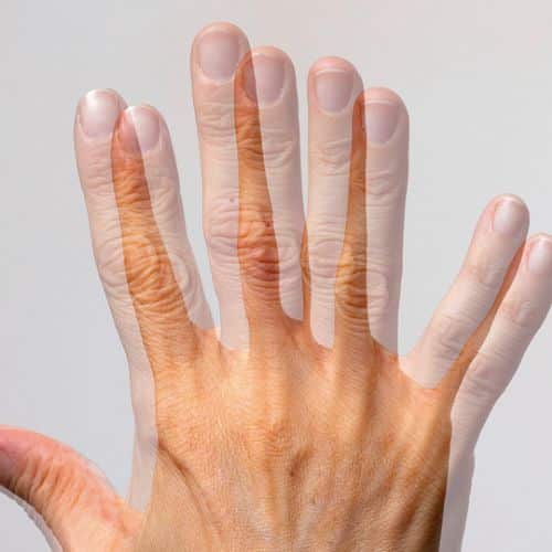 หนังตาตก เห็นภาพซ้อน