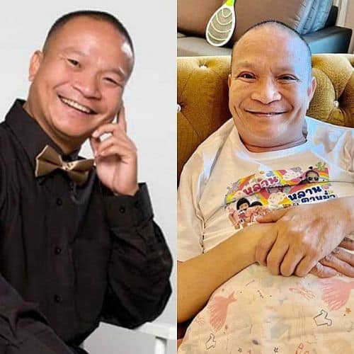 หม่ำ หนังตาตก