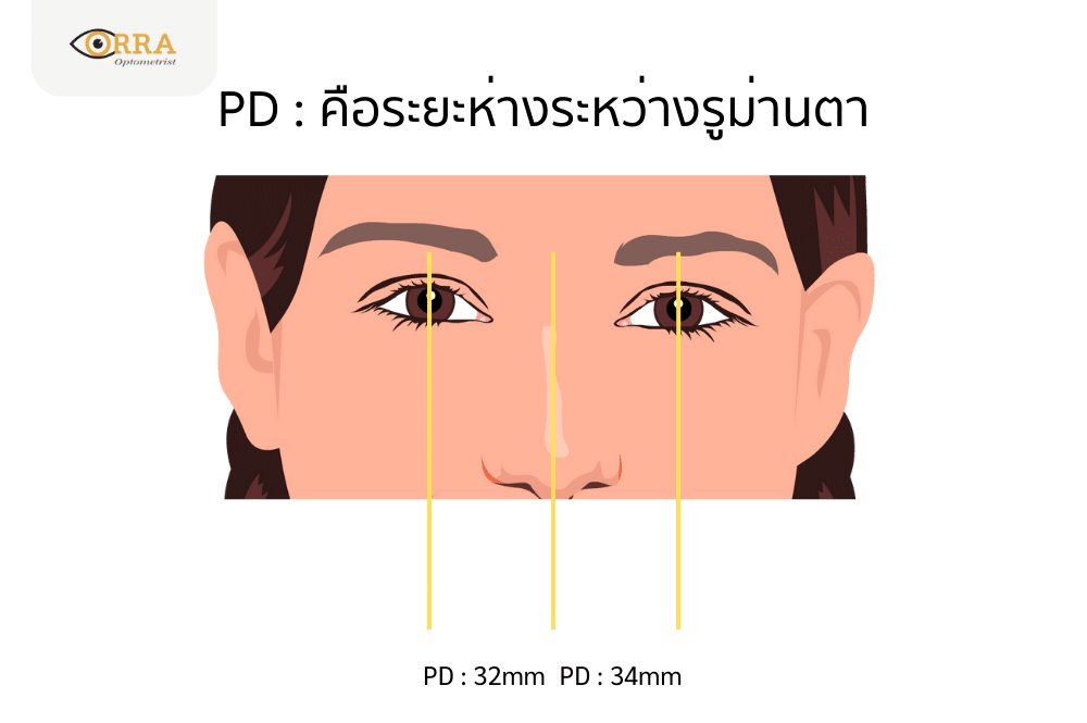 ระยะห่าระหว่างงรูม่านตา