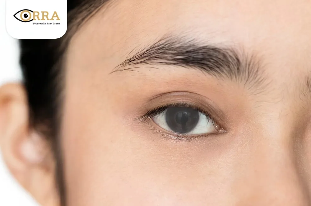 สาเหตุต้อกระจก