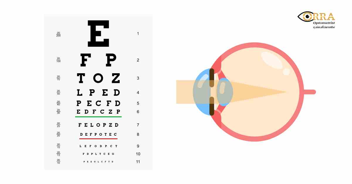สายตาสั้น