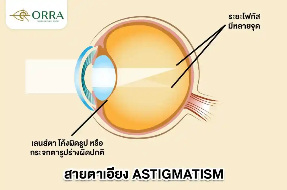 สายตาเอียง เห็นภาพซ้อน