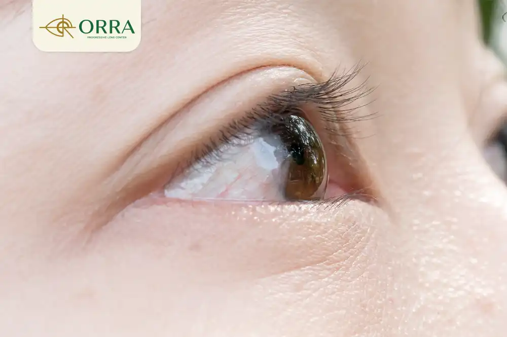 โรคทางตา ที่พบบ่อย